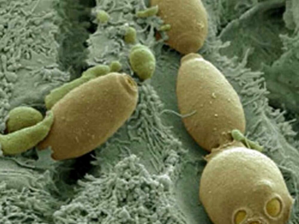 S.Boulardii For Giardia - Think Of Probiotics